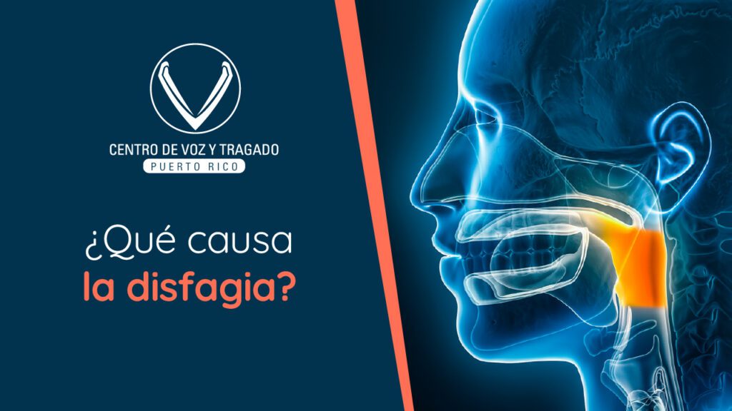 ¿Qué causa la disfagia?