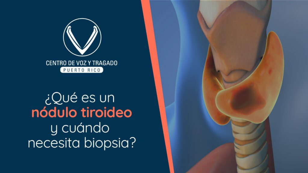 ¿Qué es un nódulo tiroideo y cuándo necesita biopsia?