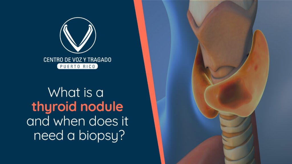 ¿Qué es un nódulo tiroideo y cuándo necesita biopsia?