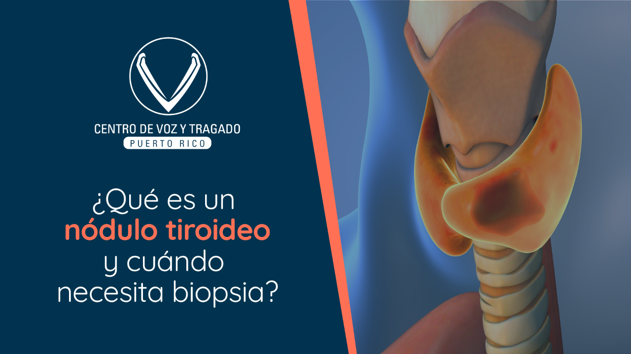 ¿Qué es un nódulo tiroideo y cuándo necesita biopsia?
