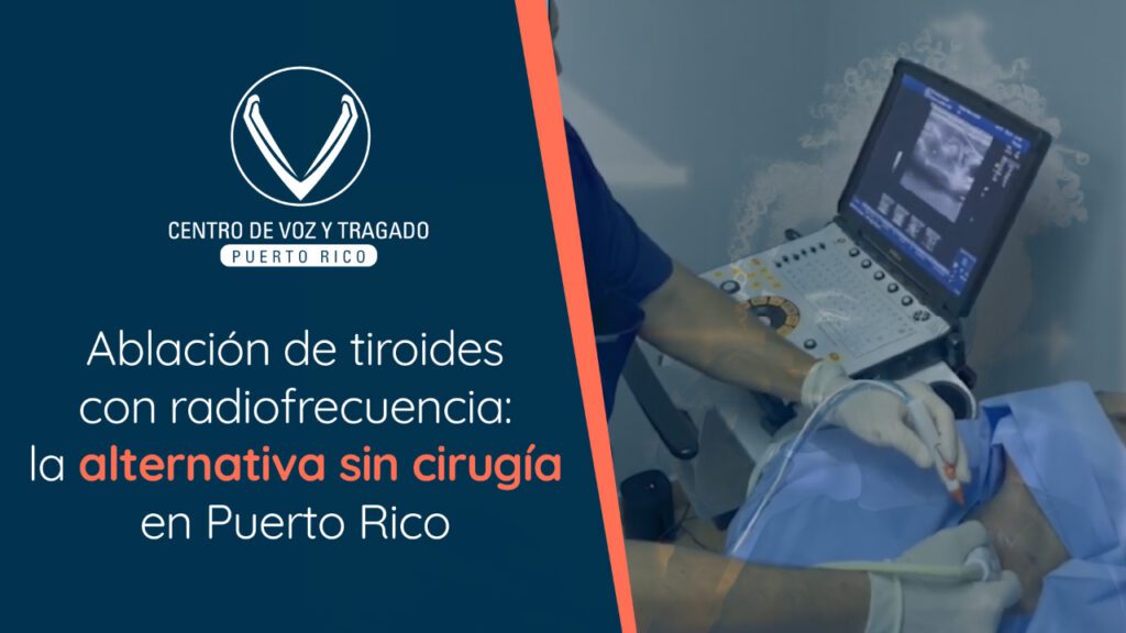Ablación de tiroides con radiofrecuencia: la alternativa sin cirugía en Puerto Rico