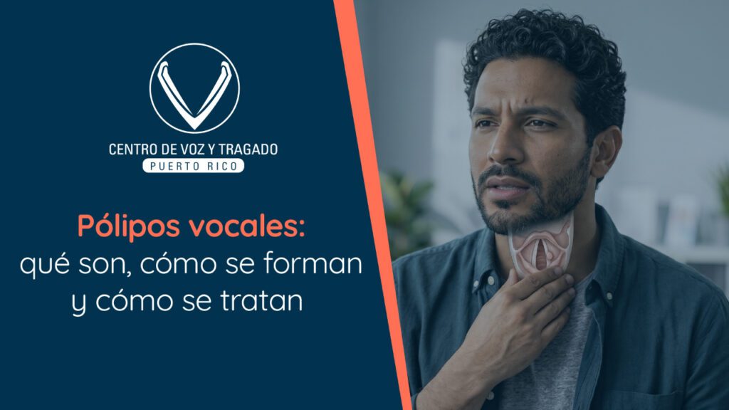 Pólipos vocales: qué son, cómo se forman y cómo se tratan