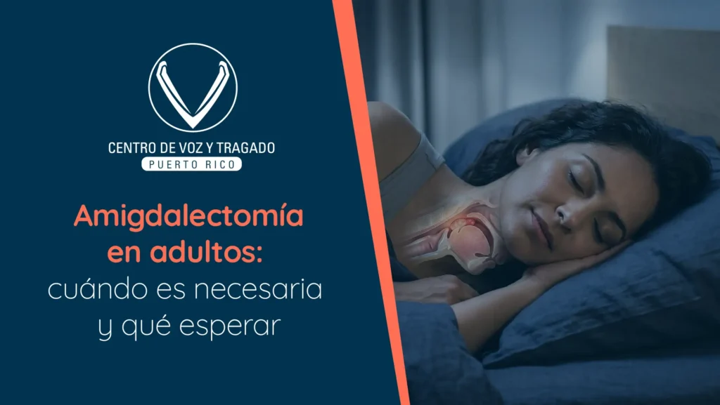 Amigdalectomía en adultos: cuándo es necesaria y qué esperar